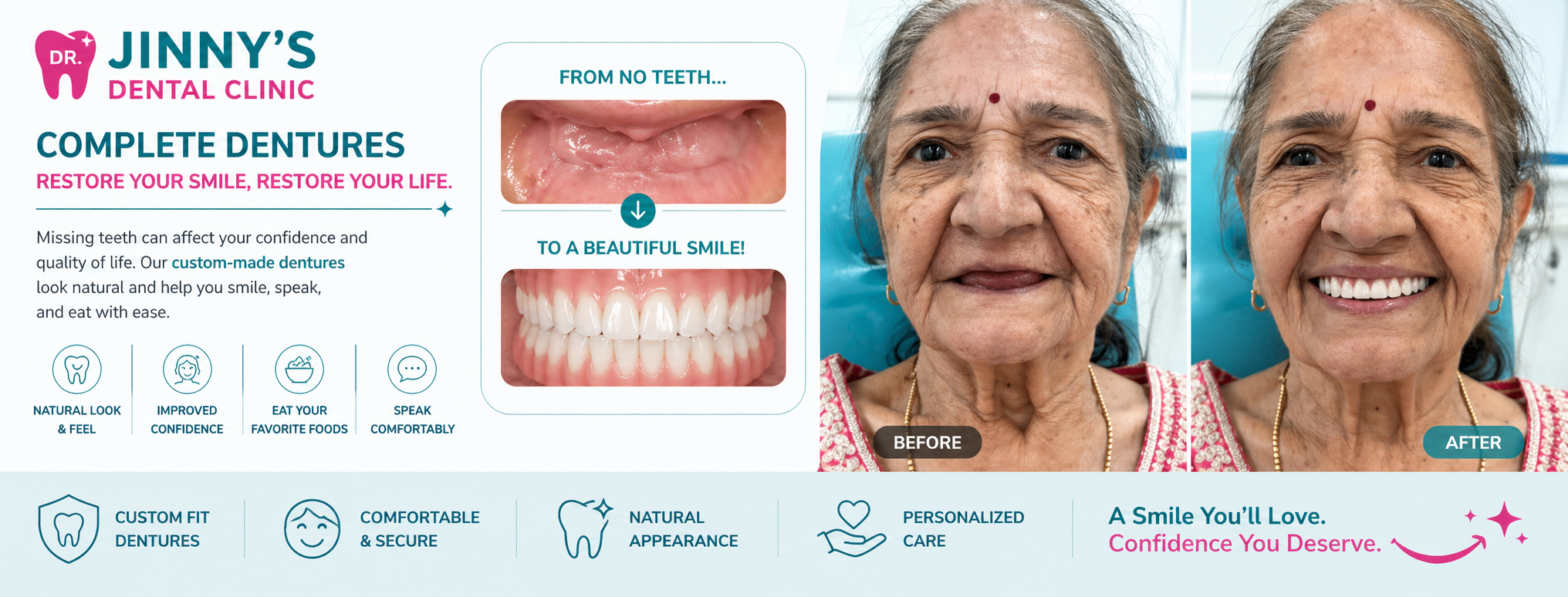 Complete & Partial Dentures in Shela, Ahmedabad at Dr. Jinny's Dental Clinic Shela