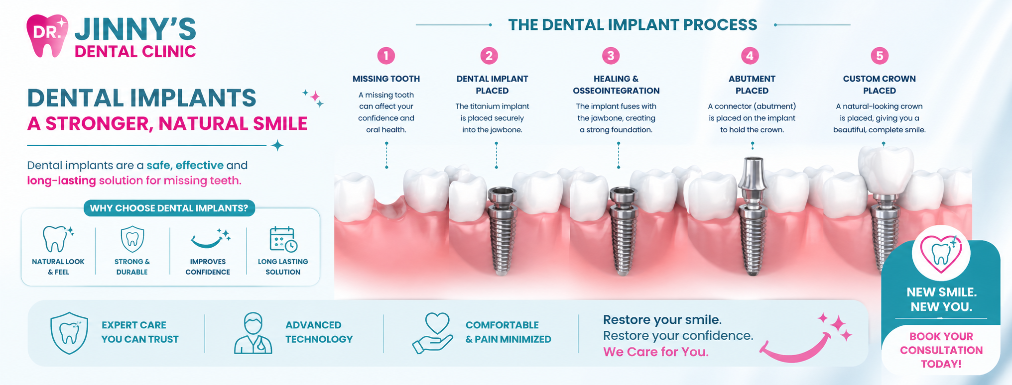 Dental Implants in Shela, Ahmedabad at Dr. Jinny's Dental Clinic Shela