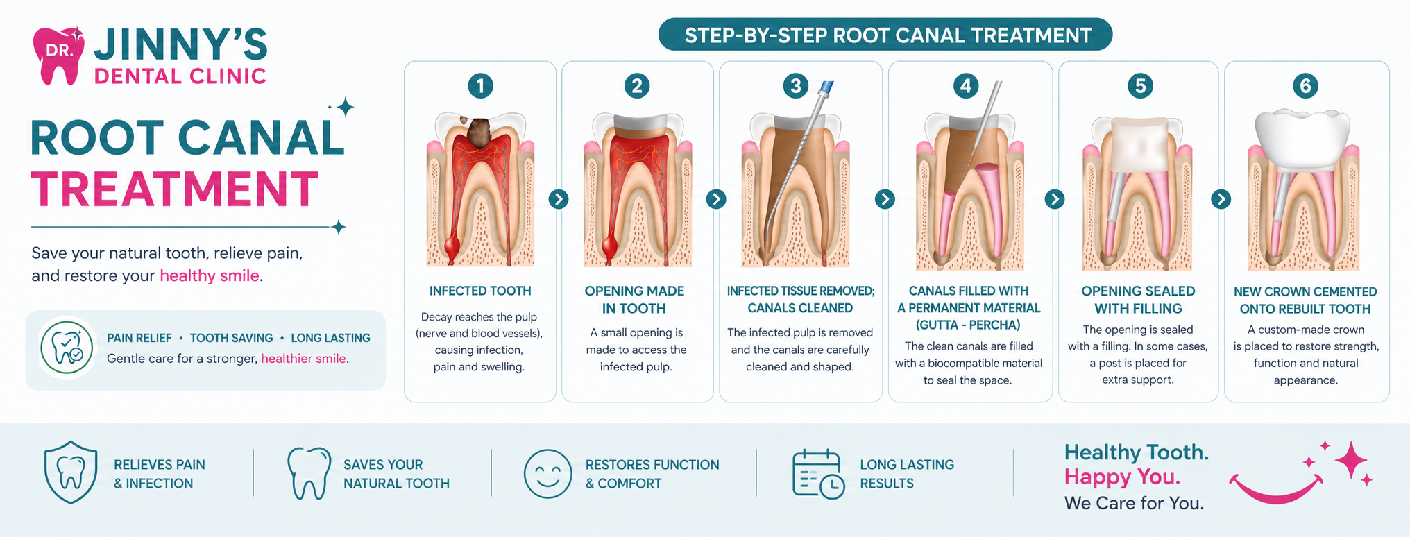 Root canal myths debunked by dentist